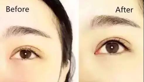美瞳线为什么这么火？(图3)